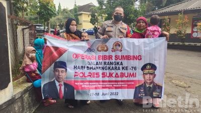 Dua Balita Bibir Sumbing Dapat Pelayanan Operasi Gratis, Dalam Rangka HUT Bhayangkara Ke 76