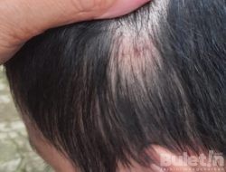 Perlakuan Majikan yang Tidak Manusiawi Terhadap ART Gadis 17 Tahun Warga Desa Cibadak Cianjur