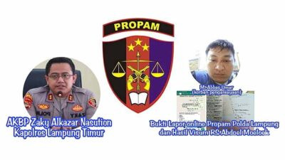 Korban Penganiayaan Oknum APH Polres Lampung Timur Menuntut Keadilan