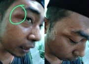 Pamekasan Memanas, Saksi Mandat PBB Diduga Dipukul Aparat saat Hendak Masuk ke Ruang Rekapitulasi